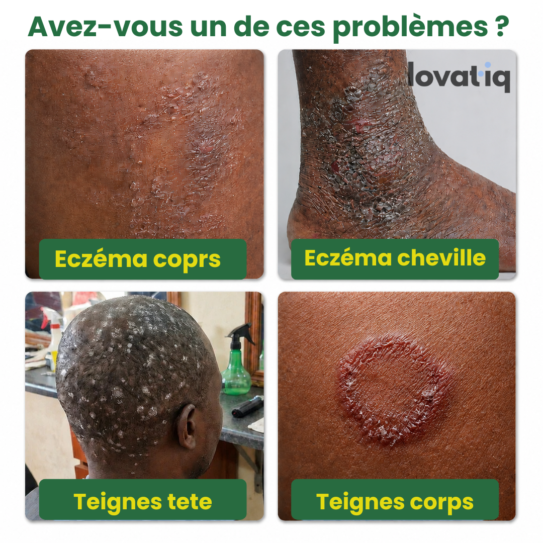 Sumifun - Retrouve une peau saine naturellement