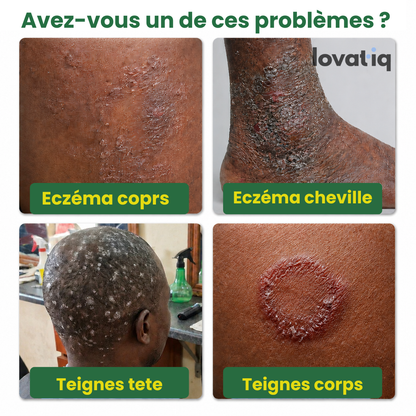 Sumifun - Retrouve une peau saine naturellement