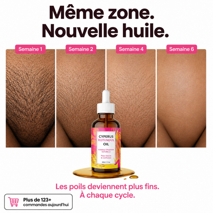 Cyperus Rotundus Oil™ | Pour une peau douce et sans irritation