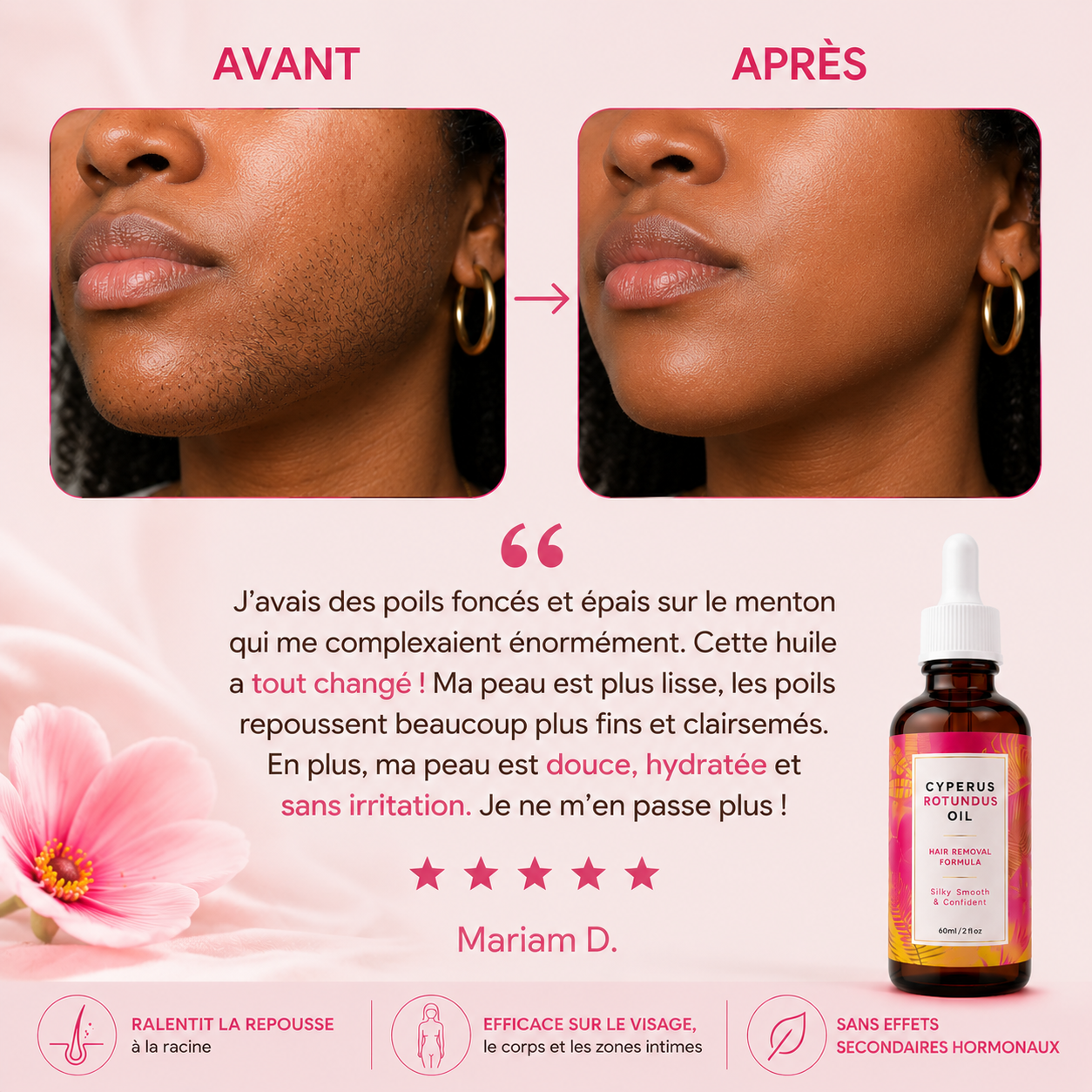Cyperus Rotundus Oil™ | Pour une peau douce et sans irritation