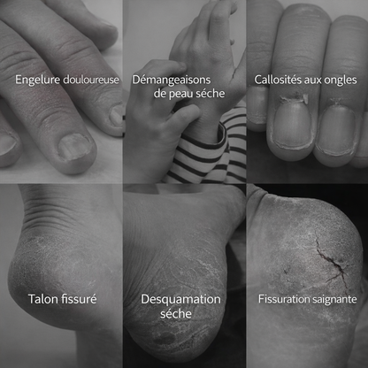 Cyndinal – Dites adieu aux talons cassés et douloureux